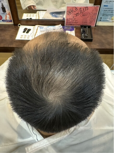 施術事例のAFTER画像