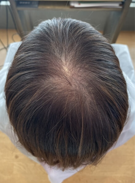 施術事例のAFTER画像