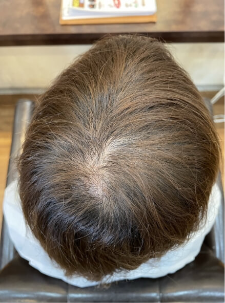 施術事例のBEFORE画像